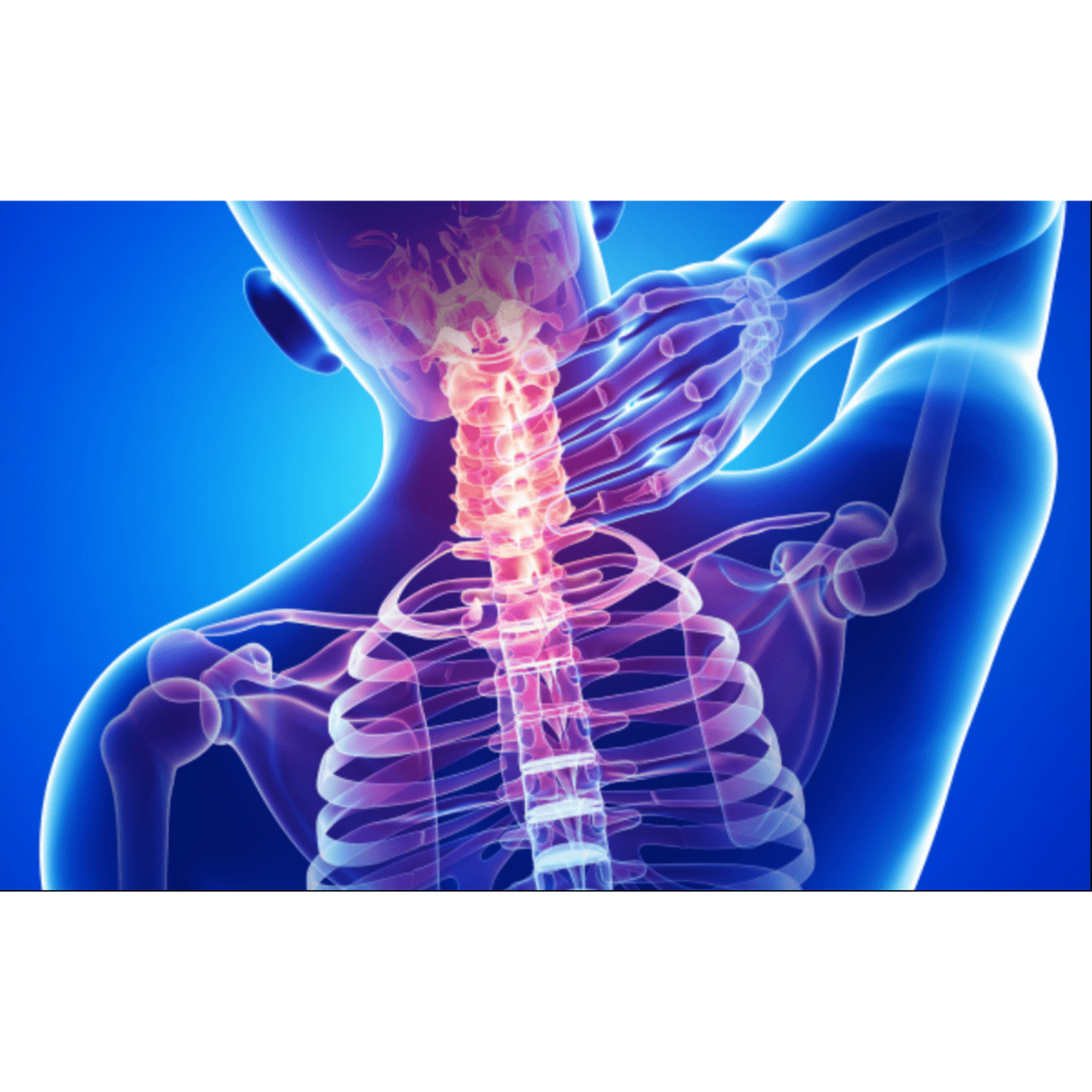 CerviDream™ — Protocole DécompPression™ Cervical